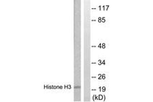 Western blot analysis of extracts from HuvEc cells, treated with Serum 20% 30', using Histone H3 (Ab-28) Antibody. (Histone 3 anticorps  (AA 13-62))