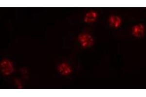 ABIN6274516 staining NIH-3T3 cells by IF/ICC. (ZNF287 anticorps)