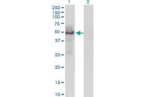 Western Blotting (WB) image for anti-Phospholipid Transfer Protein (PLTP) (AA 1-422) antibody (ABIN466078) (PLTP anticorps  (AA 1-422))
