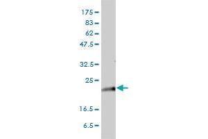 KRAS monoclonal antibody (M01), clone 3B10-2F2 Western Blot analysis of KRAS expression in HeLa .