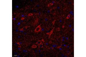 Immunofluorescence of paraffin embedded mouse spinal cord using ATP5A1 (ABIN7073141) at dilution of 1: 300 (400x lens)