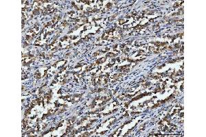 IHC analysis of Aconitase 2 using anti-Aconitase 2 antibody (ABIN7602770). (ACO2 anticorps  (C-Term))
