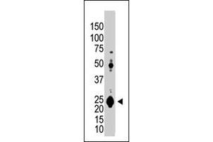 The UCHL1 polyclonal antibody  is used in Western blot to detect UCHL1 in Jurkat cell lysate. (UCHL1 anticorps  (N-Term))