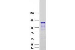 Validation with Western Blot
