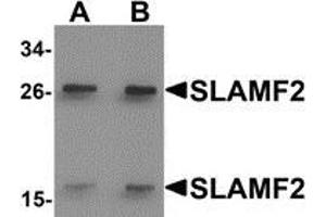 Western blot analysis of SLAMF2 in rat lung tissue lysate with SLAMF2 antibody at (A) 1 and (B) 2 μg/ml. (CD48 anticorps  (Center))