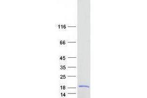 Validation with Western Blot