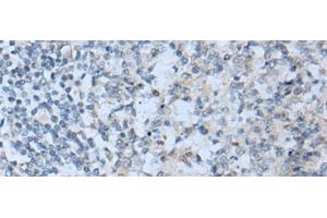 Immunohistochemistry of paraffin-embedded Human tonsil tissue using STARD4 Polyclonal Antibody at dilution of 1:50(x200) (STARD4 anticorps)