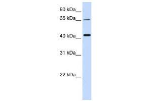 QPCTL antibody used at 1 ug/ml to detect target protein.