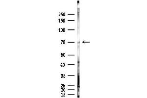 Western blot analysis of lysates from Rat brain, using ZC Antibody at 1/1000 dilution.