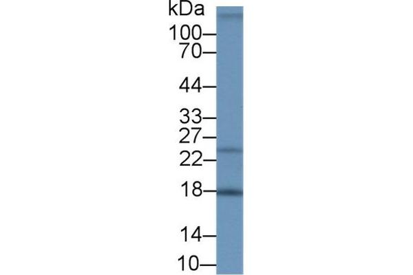 Neudesin anticorps  (AA 32-172)