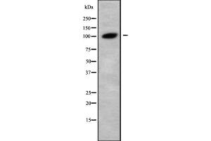 Western blot analysis Glucosidase II alpha using LOVO whole cell lysates (GANAB anticorps  (Internal Region))