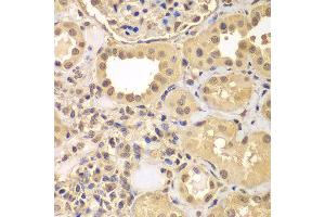Immunohistochemistry of paraffin-embedded human kidney using ARNT2 antibody at dilution of 1:100 (x40 lens). (ARNT2 anticorps)