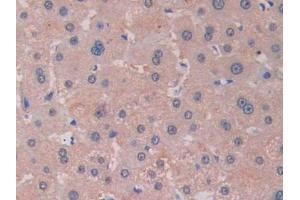 DAB staining on IHC-P; Samples: Human Liver Tissue