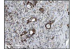 IHC analysis of VAMP4 using anti-VAMP4 antibody (ABIN7598962). (VAMP4 anticorps  (AA 1-118))