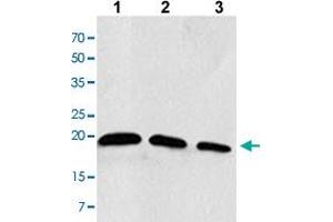 Western blot analysis of the extracts of Jurkat cells Lane 1: 30 ug, Lane 2: 20 ug, Lane 3: 10 ug with RAC2 monoclonal antibody, clone AT2G11  at 1:1000 dilution.