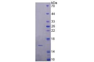 Image no. 1 for Dopamine Receptor D1 (DRD1) (AA 338-446) protein (His tag) (ABIN6236737)