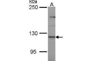 WB Image Sample (30 ug of whole cell lysate) A: JurKat 5% SDS PAGE antibody diluted at 1:1000 (PLEKHG4 anticorps  (N-Term))