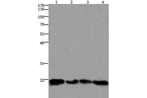Western Blot analysis of 293T and hela cell, Mouse lung and brain tissue using HMGB3 Polyclonal Antibody at dilution of 1:400 (HMGB3 anticorps)
