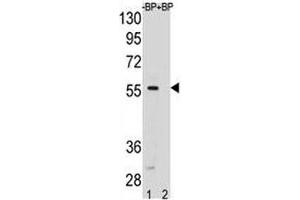 SMAD5 antibody pre-incubated without (lane 1) and with (2) blocking peptide in HeLa lysate. (SMAD5 anticorps  (AA 241-269))