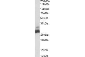 Western Blotting (WB) image for anti-rho Guanine Nucleotide Exchange Factor (GEF) 40 (ARHGEF40) (Middle Region) antibody (ABIN2156393) (ARHGEF40 anticorps  (Middle Region))