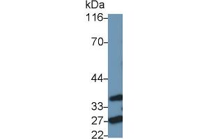 Detection of FADD in Rat Spleen lysate using Polyclonal Antibody to Fas Associating Death Domain Containing Protein (FADD)