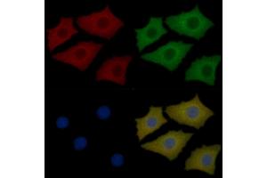 Prestin Mouse Monoclonal Antibody staining Hela cells by IF/ICC.