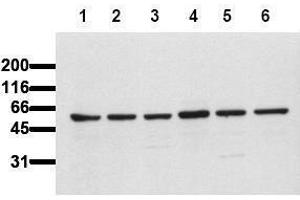Western Blotting (WB) image for anti-V-Akt Murine Thymoma Viral Oncogene Homolog 1 (AKT1) (AA 466-480) antibody (ABIN126858) (AKT1 anticorps  (AA 466-480))