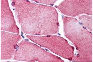 Human Skeletal Muscle: Formalin-Fixed, Paraffin-Embedded (FFPE)