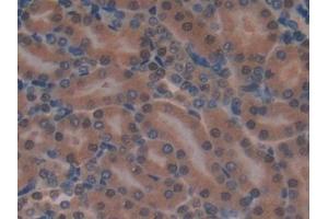 Detection of Grb7 in Mouse Kidney Tissue using Polyclonal Antibody to Growth Factor Receptor Bound Protein 7 (Grb7)