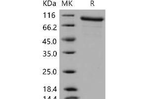 Western Blotting (WB) image for Matrix Metallopeptidase 9 (Gelatinase B, 92kDa Gelatinase, 92kDa Type IV Collagenase) (MMP9) protein (ABIN7320233)