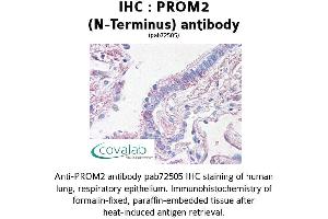 Image no. 2 for anti-Prominin 2 (PROM2) (N-Term) antibody (ABIN1738405)