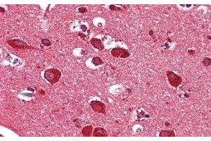 Detection of HEXb in Human Cerebrum Tissue using Polyclonal Antibody to Hexosaminidase B Beta (HEXb) (HEXB anticorps  (AA 315-456))