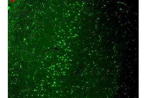 Immunohistochemistry analysis using Mouse Anti-TrpV3 Monoclonal Antibody, Clone N15/4 (ABIN361778).