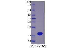 SDS-PAGE analysis of Mouse OTOR Protein.