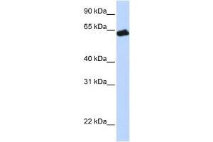 WB Suggested Anti-GHR Antibody Titration:  0. (Growth Hormone Receptor anticorps  (N-Term))