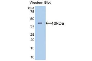 Western blot analysis of the recombinant protein. (ADAMTS1 anticorps  (AA 560-911))