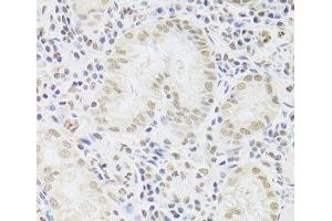 Immunohistochemistry of paraffin-embedded Human stomach using SNRPA Polyclonal Antibody at dilution of 1:100 (40x lens).