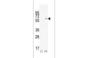 Western blot analysis of TIEG using rabbit polyclonal TIEG Antibody using 293 cell lysates (2 ug/lane) either nontransfected (Lane 1) or transiently transfected (Lane 2) with the TIEG gene. (KLF10/TIEG1 anticorps  (AA 198-225))