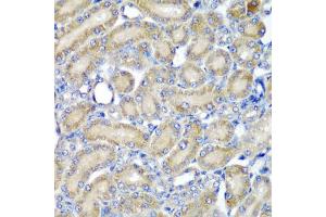 Immunohistochemistry of paraffin-embedded rat kidney using PDCD6 antibody (ABIN5974030) at dilution of 1/200 (40x lens). (PDCD6 anticorps)