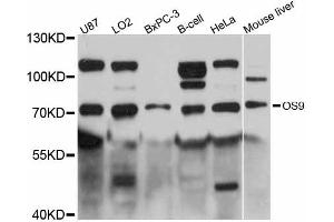 Western blot analysis of extracts of various cell lines, using OS9 antibody (ABIN5998420) at 1:3000 dilution. (OS9 anticorps)