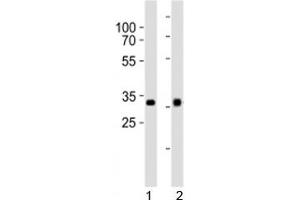 Western blot analysis of lysate from 1) HepG2 and 2) Y79 cell line using OTX2 antibody at 1:1000. (OTX2 anticorps  (C-Term))