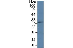 Western Blot; Sample: Mouse Lymph node lysate; Primary Ab: 3µg/ml Rabbit Anti-Human LAT Antibody Second Ab: 0.