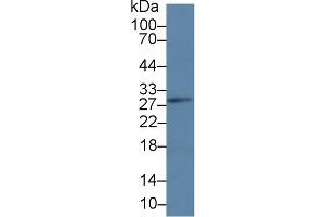 Western Blot; Sample: Mouse Lymph node lysate; Primary Ab: 3µg/ml Rabbit Anti-Human LAT Antibody Second Ab: 0. (LAT anticorps  (AA 25-221))