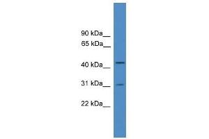 Western Blot showing OTUD6A antibody used at a concentration of 1-2 ug/ml to detect its target protein. (OTUD6A anticorps  (Middle Region))