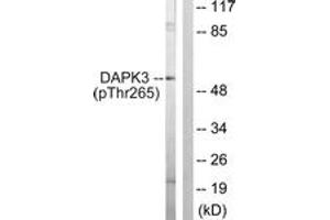 Western blot analysis of extracts from HuvEc cells, using DAPK3 (Phospho-Thr265) Antibody. (DAPK3 anticorps  (pThr265))