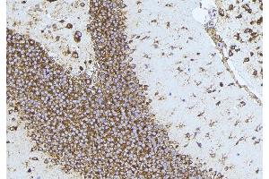 ABIN6276376 at 1/100 staining Mouse brain tissue by IHC-P.