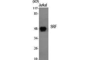 Western Blotting (WB) image for anti-Serum Response Factor (SRF) (Tyr118) antibody (ABIN3187054)