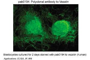 Image no. 1 for anti-Vezatin, Adherens Junctions Transmembrane Protein (VEZT) antibody (ABIN347059)