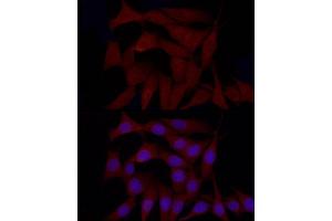 Immunofluorescence analysis of NIH/3T3 cells using SREBF1 Rabbit pAb (ABIN7270598) at dilution of 1:100 (40x lens).