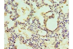 Immunohistochemistry of paraffin-embedded human lung tissue using ABIN7151443 at dilution of 1:100 (EGLN1 anticorps  (AA 301-426))